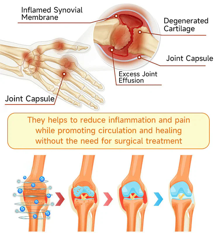 🥰𝑶𝒇𝒇𝒊𝒄𝒊𝒂𝒍 𝑺𝒕𝒐𝒓𝒆  | Rolimey® Bee Venom Pain Relief Bone Healing Cream 👨‍⚕️(Reduction of joint swelling, pain, stiffness, redness, heat, muscle soreness and joint fatigue)