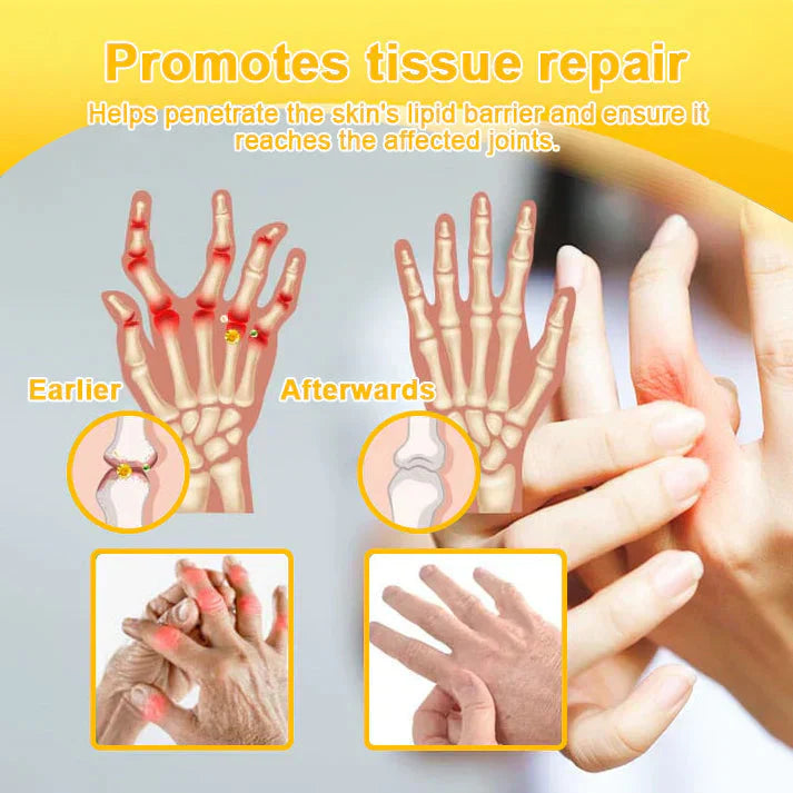 🥰𝑶𝒇𝒇𝒊𝒄𝒊𝒂𝒍 𝑺𝒕𝒐𝒓𝒆  | Rolimey® Bee Venom Pain Relief Bone Healing Cream 👨‍⚕️(Reduction of joint swelling, pain, stiffness, redness, heat, muscle soreness and joint fatigue)
