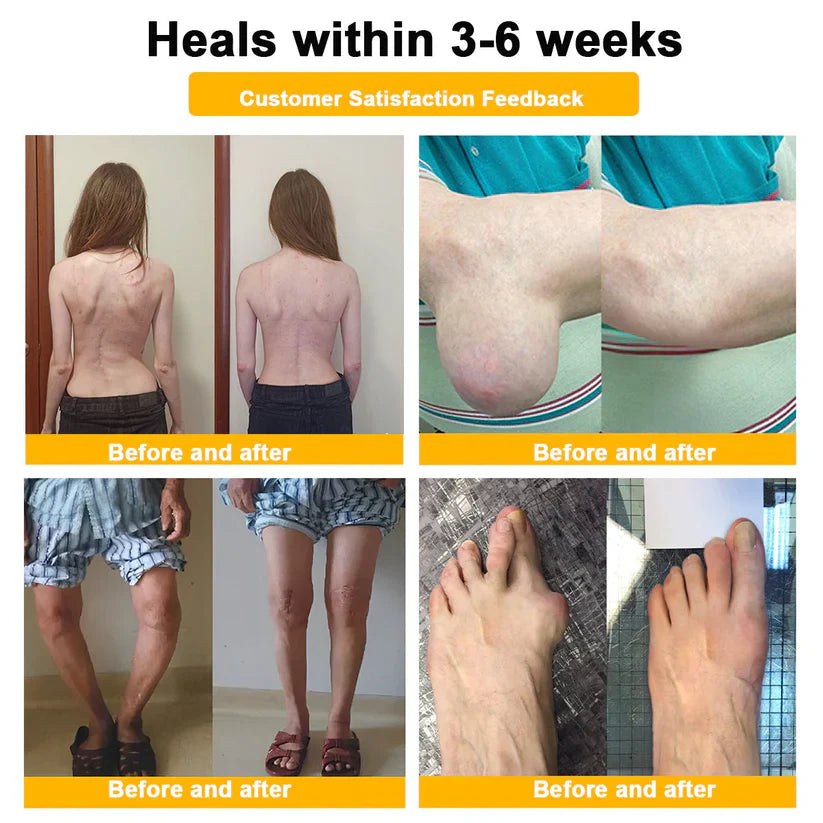 🥰𝑶𝒇𝒇𝒊𝒄𝒊𝒂𝒍 𝑺𝒕𝒐𝒓𝒆  | Rolimey® Bee Venom Pain Relief Bone Healing Cream 👨‍⚕️(Reduction of joint swelling, pain, stiffness, redness, heat, muscle soreness and joint fatigue)