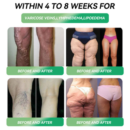 🧑‍⚕️𝑶𝒇𝒇𝒊𝒄𝒊𝒂𝒍 𝑺𝒕𝒐𝒓𝒆  |🌿GFOUK® 𝐁𝐫𝐨𝐰𝐧𝐅𝐚𝐭 𝐄𝐱𝐭𝐫𝐚𝐜𝐭 𝐍𝐚𝐧𝐨 𝐌𝐢𝐜𝐫𝐨𝐧𝐞𝐞𝐝𝐥𝐞 𝐏𝐚𝐭𝐜𝐡(𝙅𝙪𝙨𝙩 𝙤𝙣𝙘𝙚 𝙖 𝙙𝙖𝙮, 𝙫𝙞𝙨𝙞𝙗𝙡𝙚 𝙘𝙝𝙖𝙣𝙜𝙚𝙨 𝙞𝙣 7 𝙙𝙖𝙮𝙨)✅ 𝐅𝐨𝐫 𝐨𝐛𝐞𝐬𝐢𝐭𝐲, 𝐜𝐚𝐫𝐝𝐢𝐨𝐯𝐚𝐬𝐜𝐮𝐥𝐚𝐫 𝐡𝐞𝐚𝐥𝐭𝐡, 𝐝𝐢𝐚𝐛𝐞𝐭𝐞𝐬, 𝐬𝐥𝐞𝐞𝐩 𝐚𝐩𝐧𝐞𝐚, 𝐆𝐮𝐭 𝐇𝐞𝐚𝐥𝐭𝐡, 𝐣𝐨𝐢𝐧𝐭 𝐢𝐬𝐬𝐮𝐞𝐬, 𝐚𝐧𝐝 𝐦𝐨𝐫𝐞