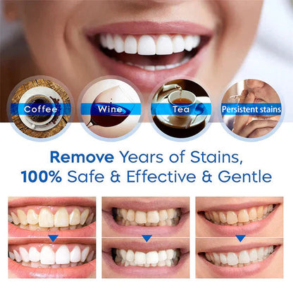 𝑶𝒇𝒇𝒊𝒄𝒊𝒂𝒍 𝑺𝒕𝒐𝒓𝒆 |𝐑𝐄𝐊𝐔𝐋𝐎™ 👩‍⚕️Teeth Whitening Pen