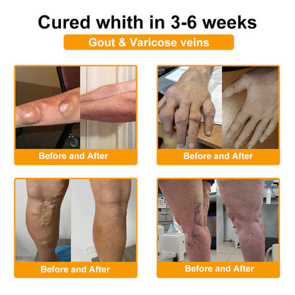 🥰𝑶𝒇𝒇𝒊𝒄𝒊𝒂𝒍 𝑺𝒕𝒐𝒓𝒆  | Rolimey® Bee Venom Pain Relief Bone Healing Cream 👨‍⚕️(Reduction of joint swelling, pain, stiffness, redness, heat, muscle soreness and joint fatigue)