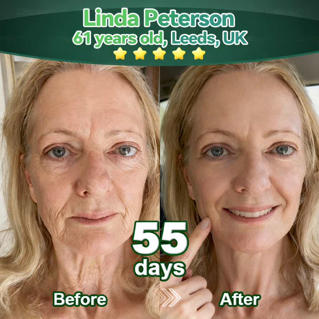 🌿Change from the inside out | Rolimey® Stem Cell–Derived EGF & Copper Peptide Activating Serum  (Deeply activates skin renewal from within for firmer, smoother-looking skin)