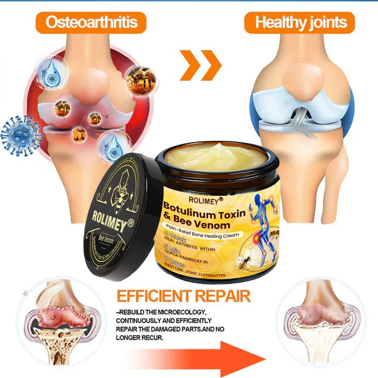 🥰𝑶𝒇𝒇𝒊𝒄𝒊𝒂𝒍 𝑺𝒕𝒐𝒓𝒆  | Rolimey® Bee Venom Pain Relief Bone Healing Cream 👨‍⚕️(Reduction of joint swelling, pain, stiffness, redness, heat, muscle soreness and joint fatigue)
