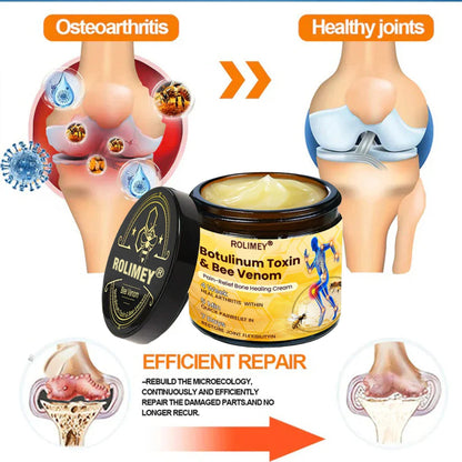 🥰𝑶𝒇𝒇𝒊𝒄𝒊𝒂𝒍 𝑺𝒕𝒐𝒓𝒆  | Rolimey® Bee Venom Pain Relief Bone Healing Cream 👨‍⚕️(Reduction of joint swelling, pain, stiffness, redness, heat, muscle soreness and joint fatigue)