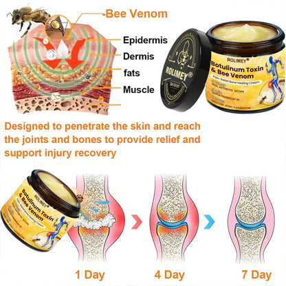 🥰𝑶𝒇𝒇𝒊𝒄𝒊𝒂𝒍 𝑺𝒕𝒐𝒓𝒆  | Rolimey® Bee Venom Pain Relief Bone Healing Cream 👨‍⚕️(Reduction of joint swelling, pain, stiffness, redness, heat, muscle soreness and joint fatigue)