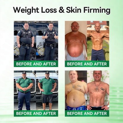 🧑‍⚕️𝑶𝒇𝒇𝒊𝒄𝒊𝒂𝒍 𝑺𝒕𝒐𝒓𝒆  | GFOUK®✨𝑴𝒐𝒓𝒊𝒏𝒈𝗮 · 𝗕𝗲𝗿𝗯𝗲𝗿𝙞𝙣𝙚 × 𝙉𝘼𝐃+ 𝟏𝟎-𝐢𝐧-𝟏 𝗔𝗱𝘃𝗮𝗻𝗰𝙚𝙙 𝙉𝙖𝙣𝙤 𝙈𝙞𝙘𝙧𝙤𝙣𝙚𝙚𝐝𝐥𝐞 𝐏𝐚𝐭𝙘𝙝(𝐉𝐮𝐬𝐭 𝐨𝐧𝐜𝐞 𝐚 𝐝𝐚𝐲, 𝐯𝐢𝐬𝐢𝐛𝐥𝐞 𝐜𝐡𝐚𝐧𝐠𝐞𝐬 𝐢𝐧 𝟕 𝐝𝐚𝐲𝐬） ✅ 𝐅𝐨𝐫 𝐨𝐛𝐞𝐬𝐢𝐭𝐲, 🅛🅞🅞🅢🅔 🅢🅚🅘🅝,𝐝𝐢𝐚𝐛𝐞𝐭𝐞𝐬, 𝐬𝐥𝐞𝐞𝐩 𝐚𝐩𝐧𝐞𝐚, 𝐣𝐨𝐢𝐧𝐭 𝐢𝐬𝐬𝐮𝐞𝐬, 𝐚𝐧𝐝 𝐦𝐨𝐫𝐞