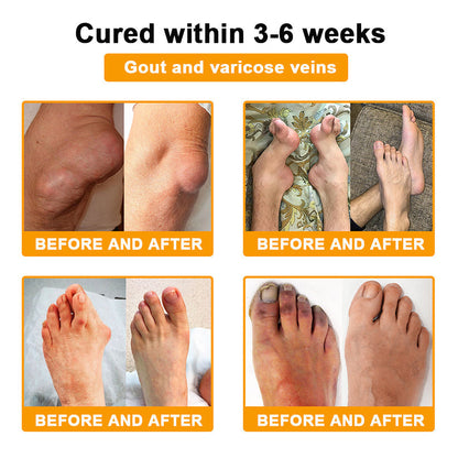 🥰𝑶𝒇𝒇𝒊𝒄𝒊𝒂𝒍 𝑺𝒕𝒐𝒓𝒆  | Rolimey® Bee Venom Pain Relief Bone Healing Cream 👨‍⚕️(Reduction of joint swelling, pain, stiffness, redness, heat, muscle soreness and joint fatigue)
