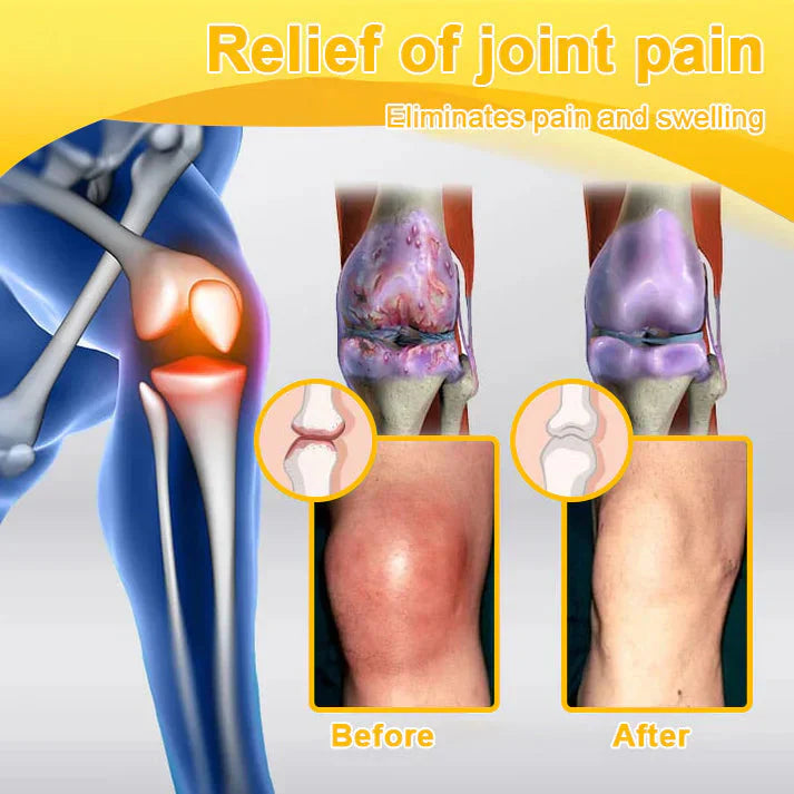 🥰𝑶𝒇𝒇𝒊𝒄𝒊𝒂𝒍 𝑺𝒕𝒐𝒓𝒆  | Rolimey® Bee Venom Pain Relief Bone Healing Cream 👨‍⚕️(Reduction of joint swelling, pain, stiffness, redness, heat, muscle soreness and joint fatigue)