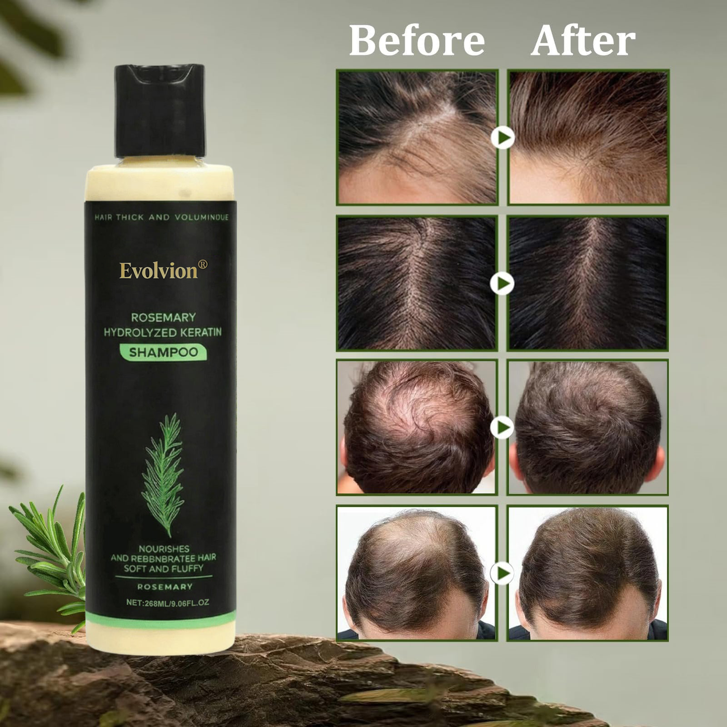 👩‍⚕️𝑶𝒇𝒇𝒊𝒄𝒊𝒂𝒍 𝑺𝒕𝒐𝒓𝒆  |🌱 Organic Rosemary Hair Growth Shampoo
