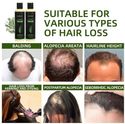 👩‍⚕️𝑶𝒇𝒇𝒊𝒄𝒊𝒂𝒍 𝑺𝒕𝒐𝒓𝒆  |🌱 Organic Rosemary Hair Growth Shampoo