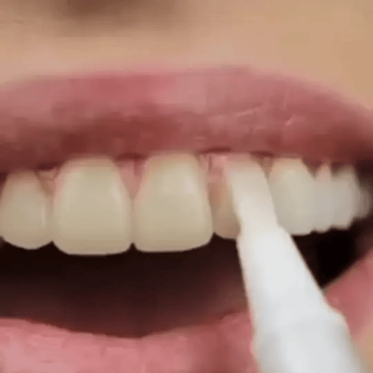 𝑶𝒇𝒇𝒊𝒄𝒊𝒂𝒍 𝑺𝒕𝒐𝒓𝒆 |𝐑𝐄𝐊𝐔𝐋𝐎™ 👩‍⚕️Teeth Whitening Pen