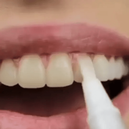 𝑶𝒇𝒇𝒊𝒄𝒊𝒂𝒍 𝑺𝒕𝒐𝒓𝒆 |𝐑𝐄𝐊𝐔𝐋𝐎™ 👩‍⚕️Teeth Whitening Pen